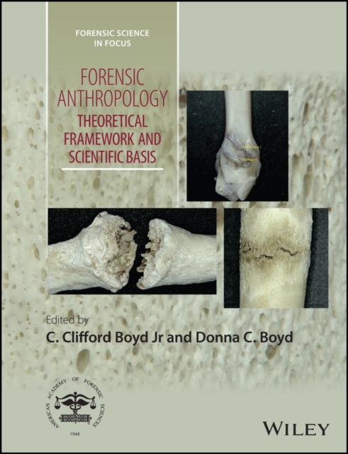 Forensic Anthropology – Theoretical Framework and Scientific Basis Boyd Hardback