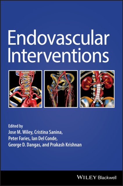 Endovascular Interventions Wiley Hardback Wiley–Blackwell 9781119283492