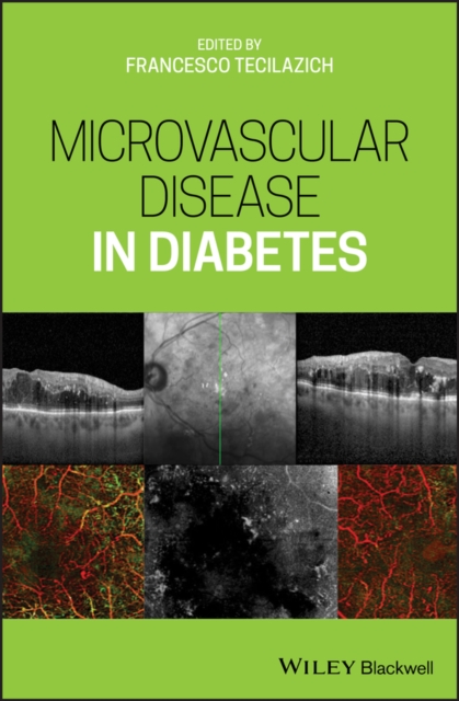Microvascular Disease in Diabetes Tecilazich Hardback Wiley–Blackwell