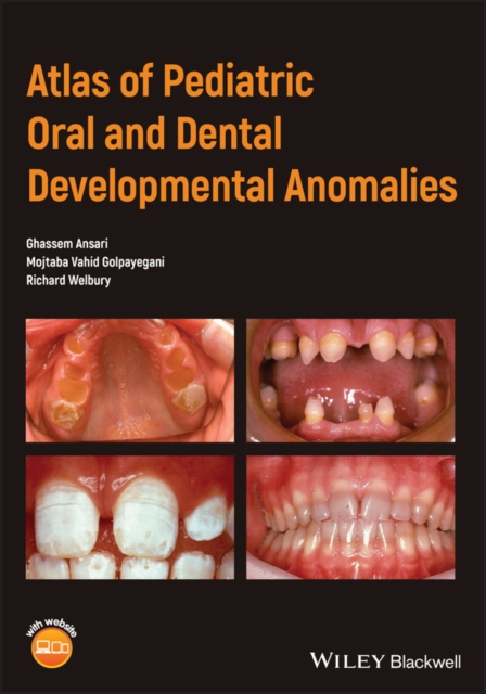 Atlas of Pediatric Oral and Dental Developmental Anomalies Ansari Paperback