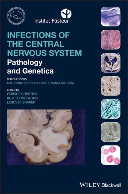 Infections of the Central Nervous System – Pathology and Genetics Chretien