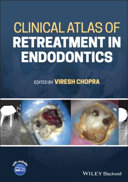 Clinical Atlas of Retreatment in Endodontics Chopra Hardback Wiley–Blackwell