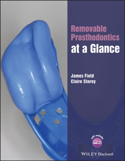 Removable Prosthodontics at a Glance Field Paperback Wiley–Blackwell