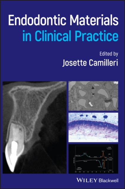 Endodontic Materials in Clinical Practice Camilleri Hardback Wiley–Blackwell