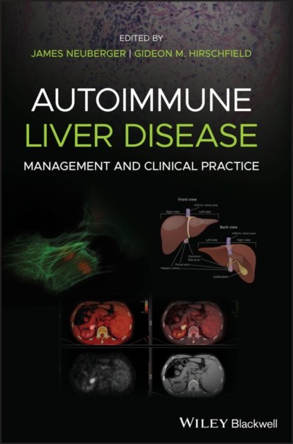 Autoimmune Liver Disease – Management and Clinical  Practice Neuberger Hardback