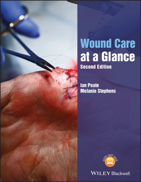 Wound Care at a Glance, Second Edition Peate Paperback Wiley–Blackwell