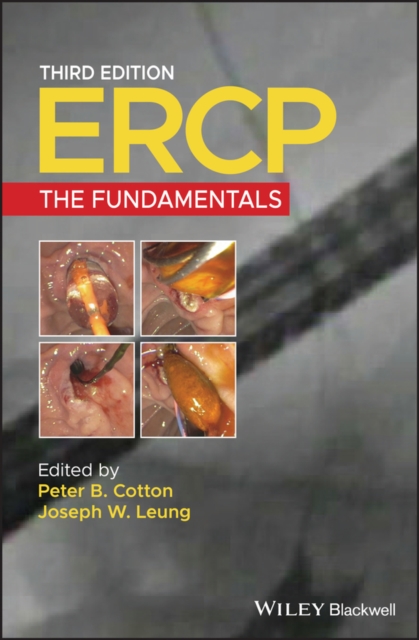 ERCP – The Fundamentals 3e Cotton Hardback Wiley–Blackwell 9781119601098