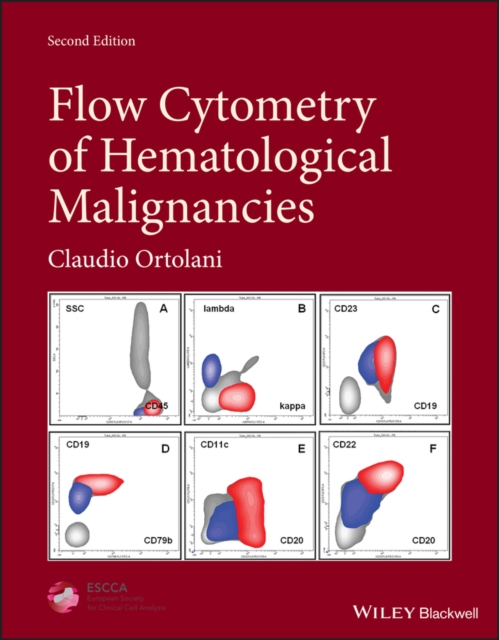 Flow Cytometry of Hematological Malignancies 2nd Edition Ortolani Hardback