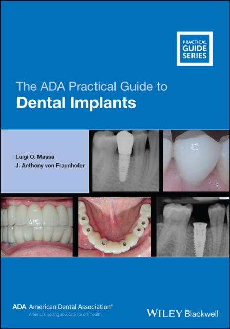 The ADA Practical Guide to Dental Implants Massa Paperback Wiley–Blackwell