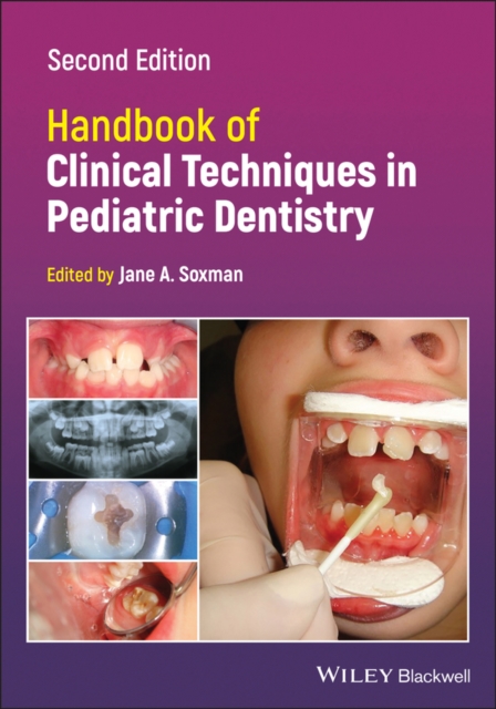 Handbook of Clinical Techniques in Pediatric Dentistry Soxman Paperback