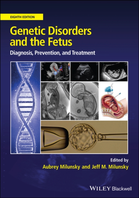 Genetic Disorders and the Fetus – Diagnosis, Prevention and Treatment Milunsky