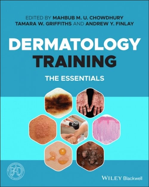 Dermatology Training – The Essentials Chowdhury Paperback Wiley–Blackwell