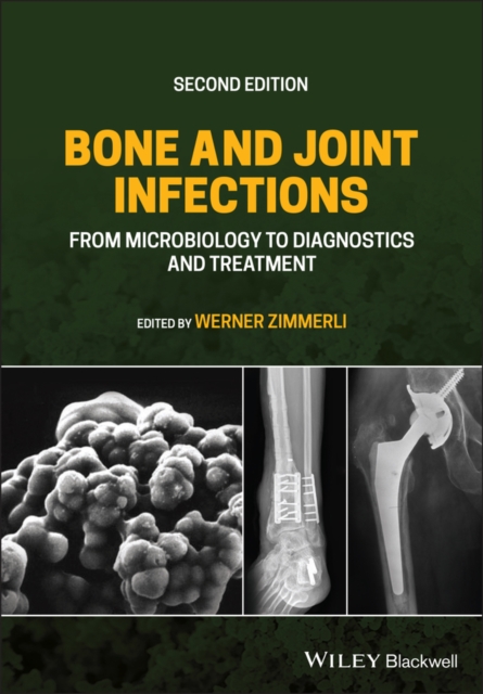 Bone and Joint Infections – From Microbiology to Diagnostics and Treatment, Sec…