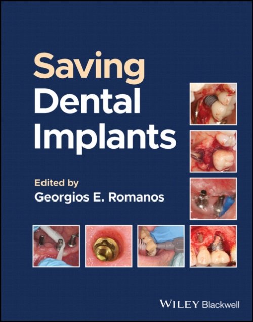 Saving Dental Implants Romanos Romanos Hardback Wiley–Blackwell 9781119807018