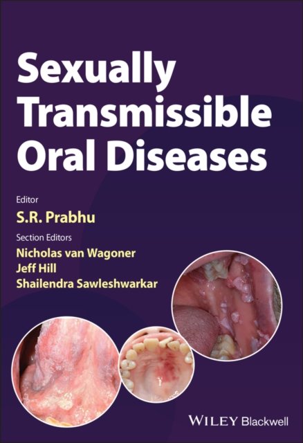 Sexually Transmissible Oral Diseases Prabhu Paperback Wiley–Blackwell