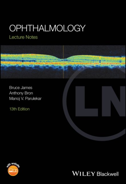 Ophthalmology: Lecture Notes James Paperback Wiley–Blackwell 9781119905974