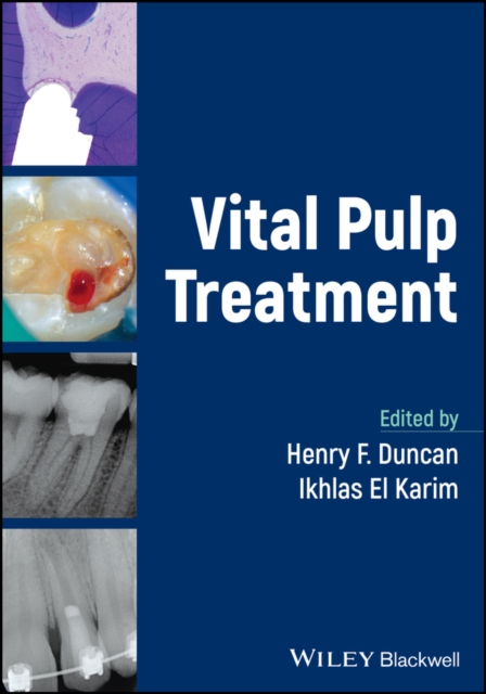 Vital Pulp Treatment Duncan El Karim Hardback Wiley–Blackwell 9781119930389