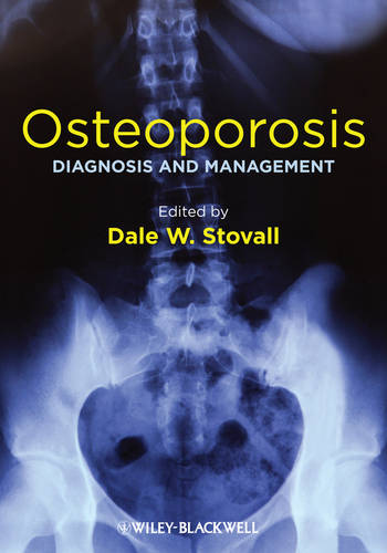 Osteoporosis – Diagnosis and Management Stovall Hardback Wiley–Blackwell