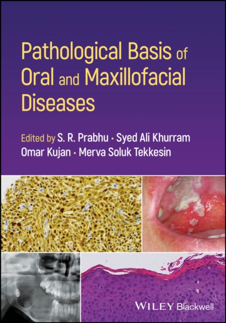 Pathological Basis of Oral and Maxillofacial Disea ses Prabhu Paperback