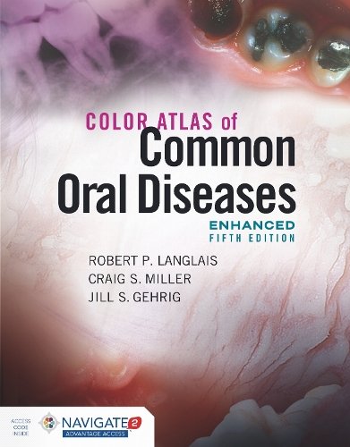 Color Atlas of Common Oral Diseases, Enhanced Edition Langlais Miller Gehrig