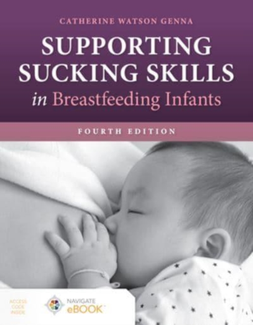 Supporting Sucking Skills in Breastfeeding Infants Watson Genna Paperback