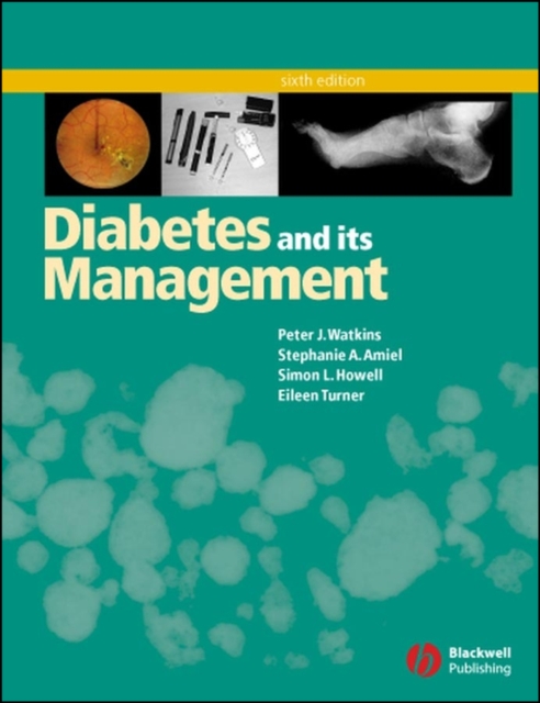 Diabetes and Its Management 6e Watkins Paperback Wiley–Blackwell 9781405107259