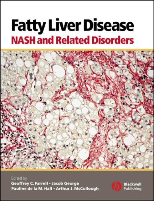 Fatty Liver Disease – NASH and Related Disorders Farrell Hardback 9781405112925
