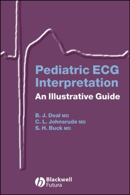 Pediatric ECG Interpretation – An Illustrative Guide Deal Paperback