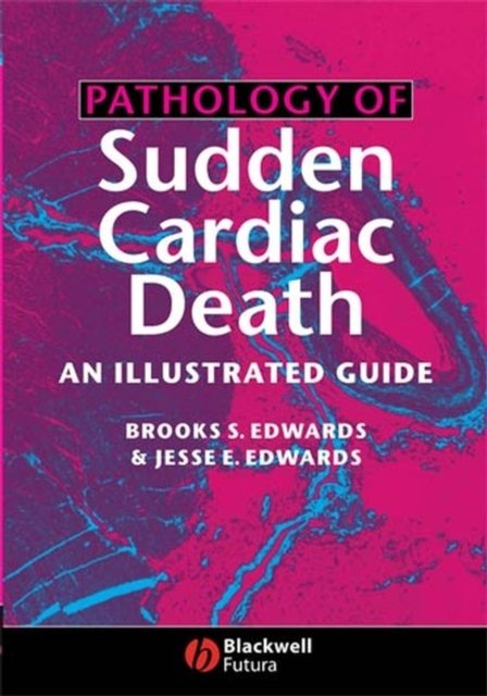 Pathology of Sudden Cardiac Death – An Illustrated  Guide Edwards Hardback
