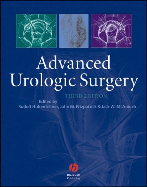 Advanced Urologic Surgery 3e Hohenfellner Hardback Wiley–Blackwell 9781405122139