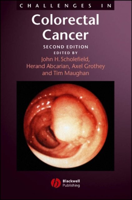 Challenges in Colorectal Cancer 2e Scholefield Hardback Wiley–Blackwell