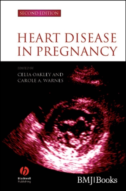 Heart Disease in Pregnancy 2e Oakley Hardback Wiley–Blackwell 9781405134880