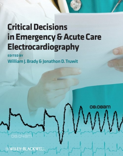 Critical Decisions in Emergency and Acute Care Electrocardiography Brady