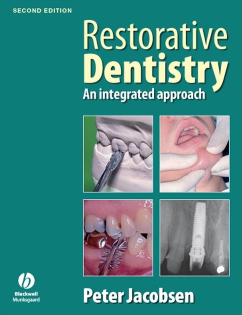 Restorative Dentistry 2e Jacobsen Paperback Wiley–Blackwell 9781405167994