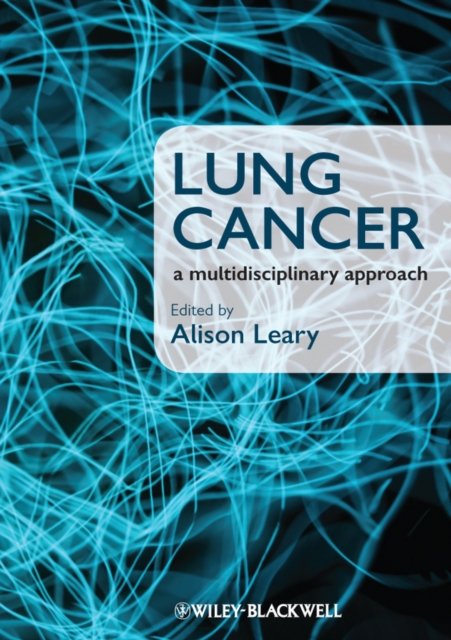 Lung Cancer – A Multidisciplinary Approach Leary Paperback Wiley–Blackwell