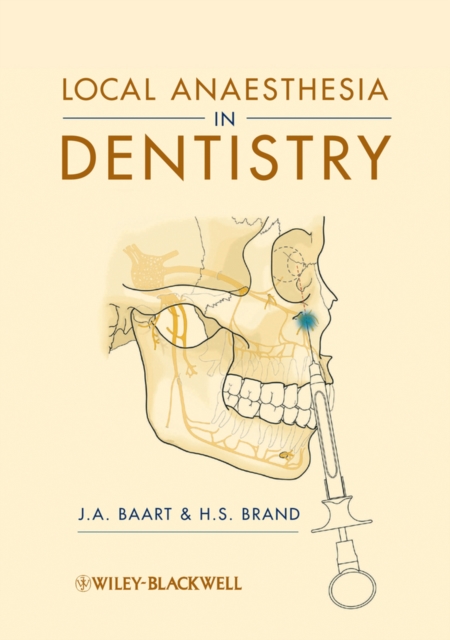 Local Anaesthesia in Dentistry Baart Paperback Wiley–Blackwell 9781405184366