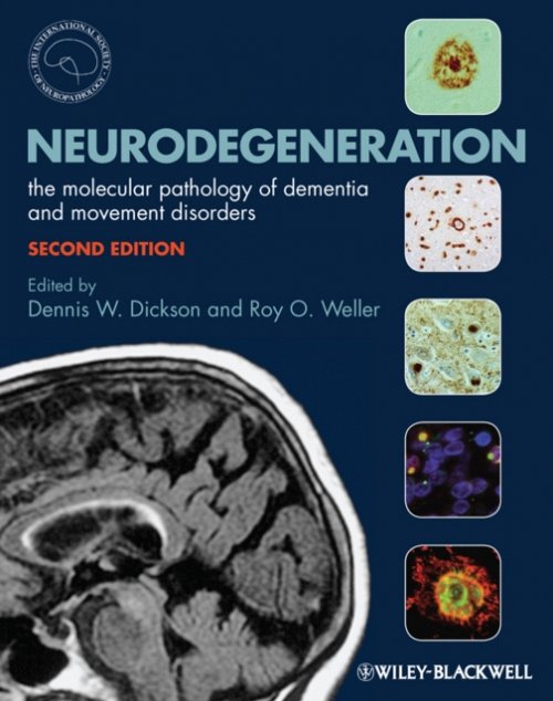 Neurodegeneration – The Molecular Pathology of Dementia and Movement Disorders …