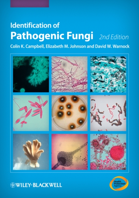 Identification of Pathogenic Fungi 2e Campbell Hardback Wiley–Blackwell