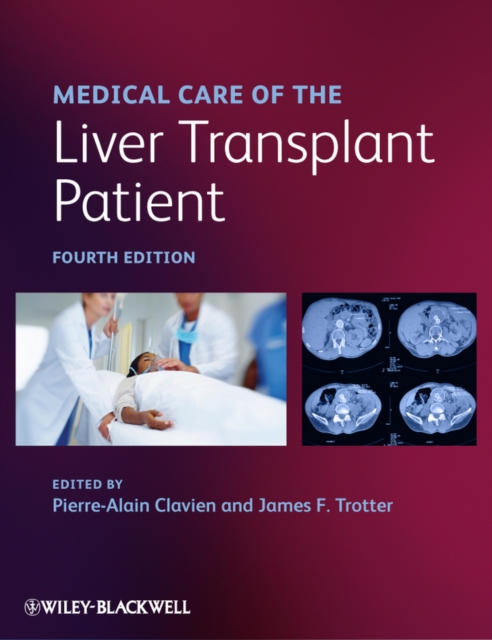 Medical Care of the Liver Transplant Patient 4e Clavien Hardback Wiley–Blackwell