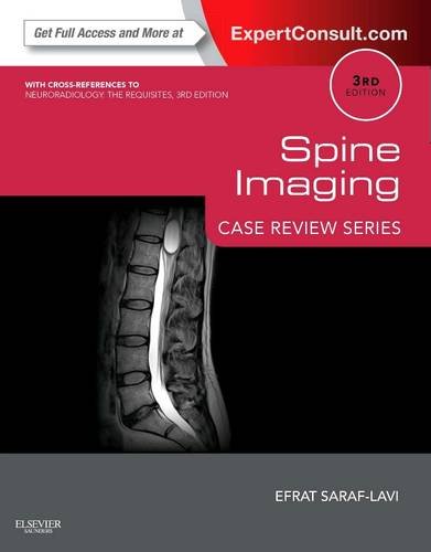 Spine Imaging: Case Review Series Expert Consult – Online and Print Paperback 3e