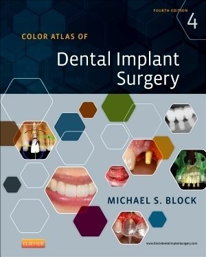 Color Atlas of Dental Implant Surgery Block Hardback Saunders 9781455759682 4e