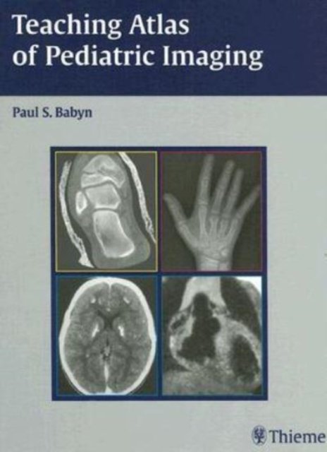 Teaching Atlas of Pediatric Imaging Babyn Hardback John Wiley & Sons