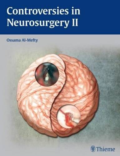 Controversies in Neurosurgery II Al–mefty Hardback John Wiley & Sons