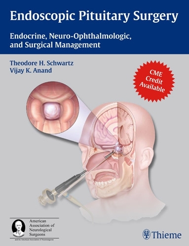 Endoscopic Pituitary Surgery – Endocrine, Neuro–Ophthalmologic, and Surgical Ma…