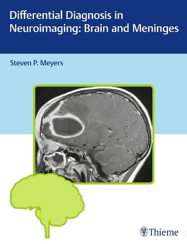 Differential Diagnosis in Neuroimaging: Brain and Meninges Meyers Hardback