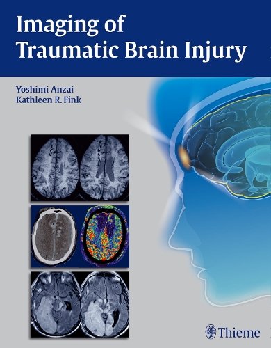 Imaging of Traumatic Brain Injury Anzai Fink Hardback MM – Thieme 9781604067286