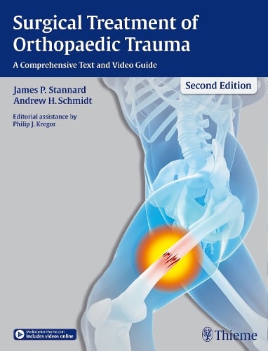 Surgical Treatment of Orthopaedic Trauma – A Comprehensive Text and Video Guide