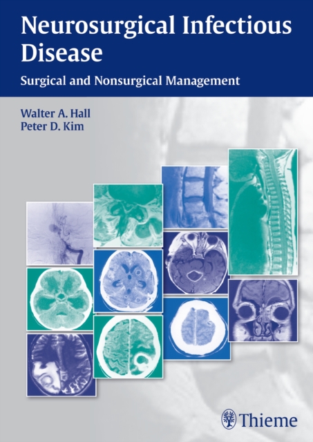 Neurosurgical Infectious Disease – Surgical and Nonsurgical Management Hall Kim