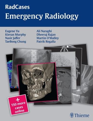 Radcases Emergency Radiology Yu Jaffer Chung Naraghi Rajan Paperback MM – Thieme