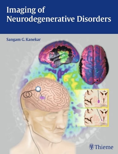 Imaging of Neurodegenerative Disorders Kanekar Hardback John Wiley & Sons